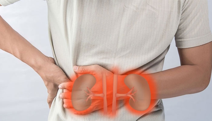 بیشتر افراد کی پسندیدہ وہ غذا جو گردوں کے تکلیف دہ امراض کا شکار بنا دیتی ہے